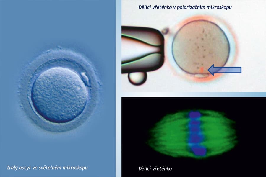 Polarizační mikroskopie Polarizační mikroskopie